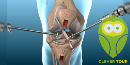 Роботизированная хирургия коленного сустава в Турции
